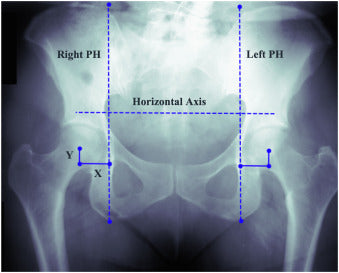 PELVIOLOGY 2 - The horizontal axes - taught by Eric Shimane, DC - 24-27th of October 2025, London, UK